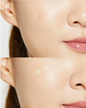 Cargar imagen en el visor de la galería, Acne Pimple Master Patch - By Cosrx